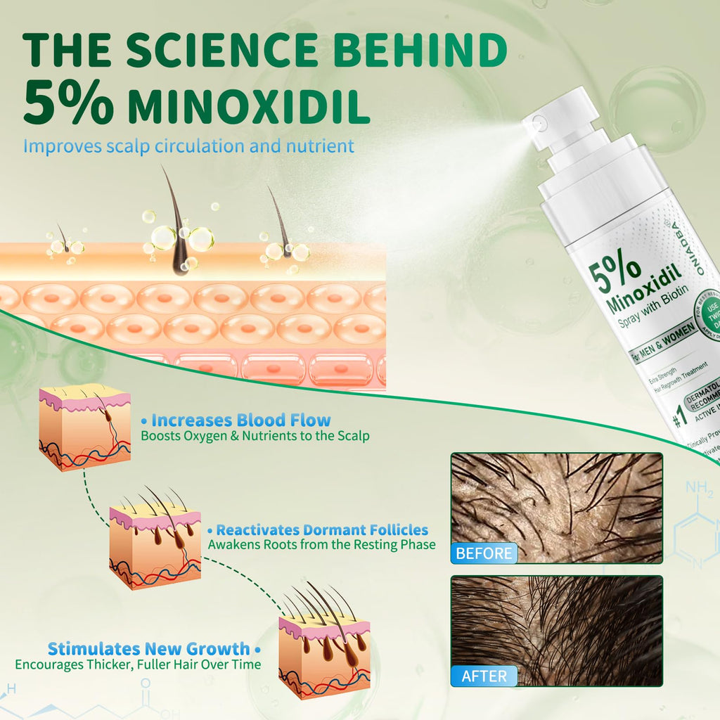 ONIADBA 5% Minoxidil Spray for Hair Growth – 4 Pack (8.12 oz each)