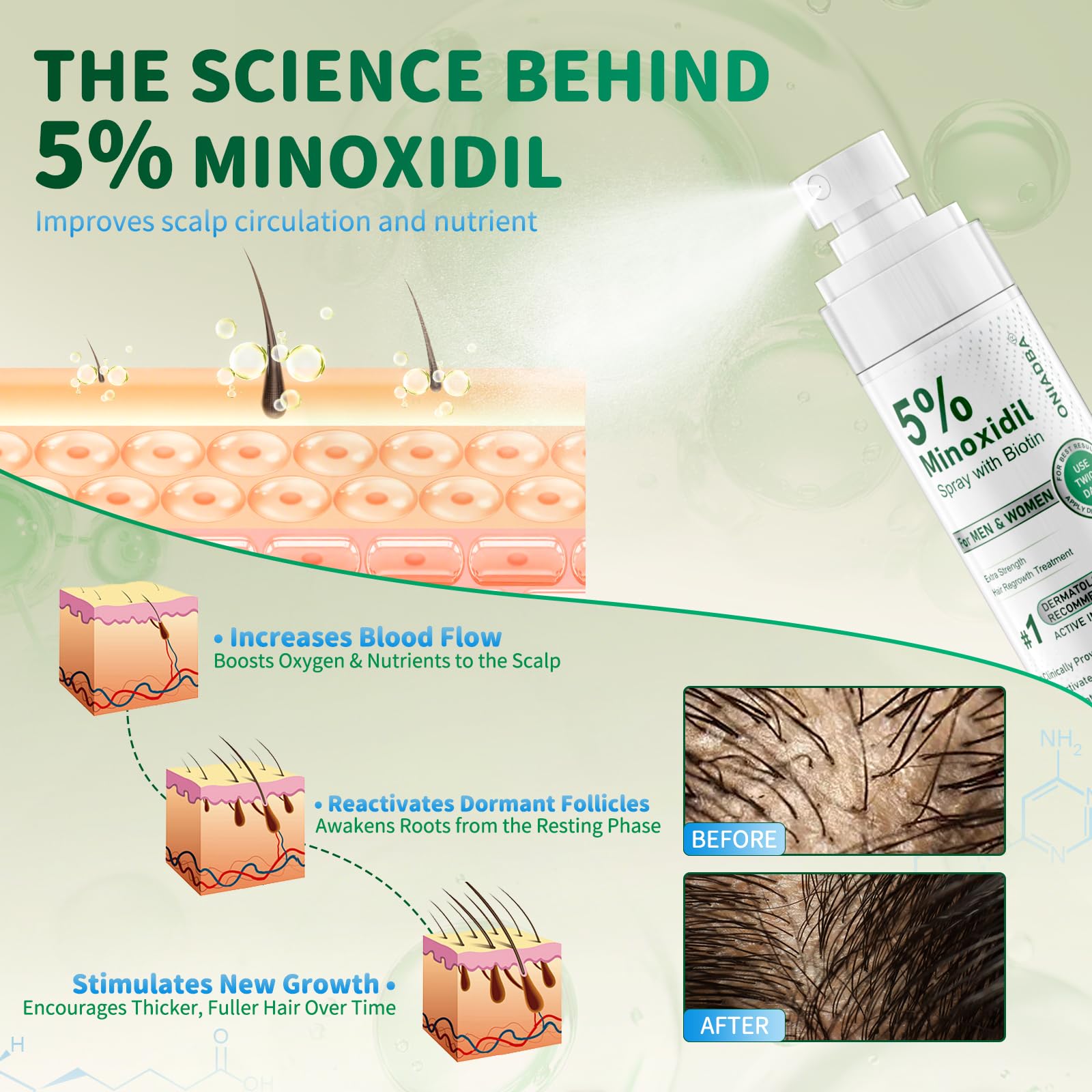 ONIADBA 5% Minoxidil Spray for Hair Growth – 4 Pack (8.12 oz each)