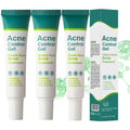 Onkessy Azelaic Acid Serum — 10% Azelaic + Salicylic Acid for Acne & Pore Refinement, 30ml
