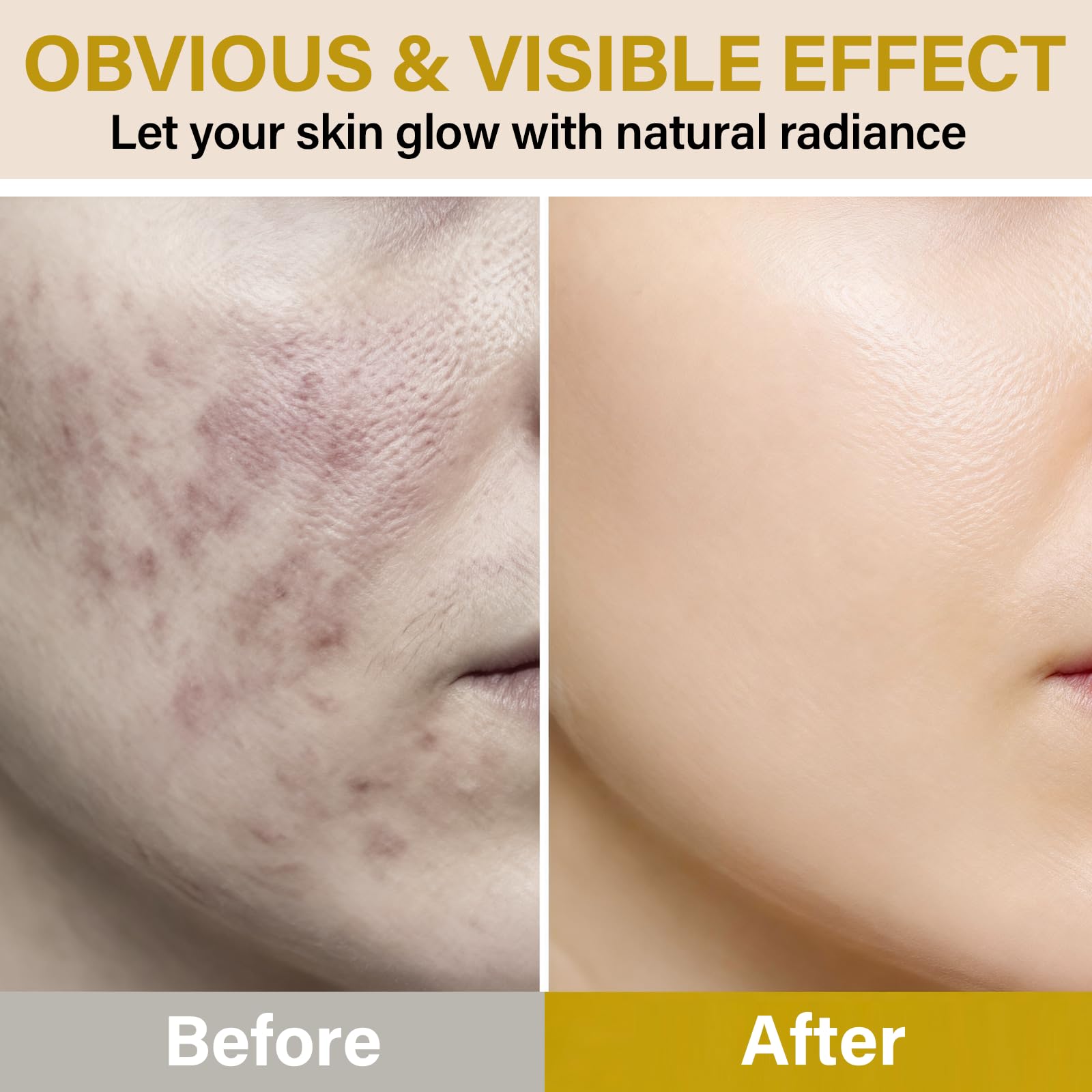 Onzzyl Bee Venom Cream – Instant Lift & Firm Anti-Aging Face Cream for All Skin Types