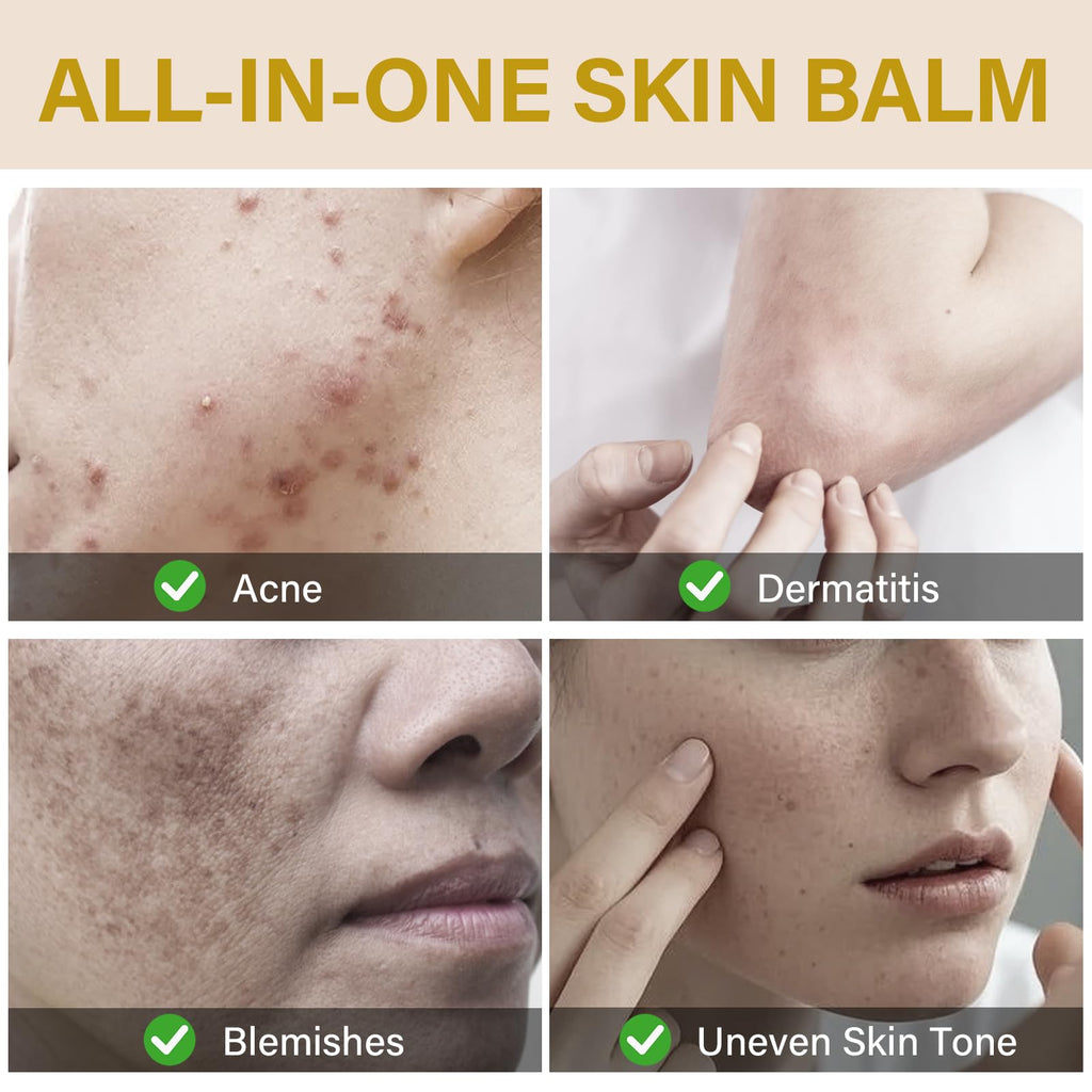 Onzzyl Bee Venom Cream – Instant Lift & Firm Anti-Aging Face Cream for All Skin Types