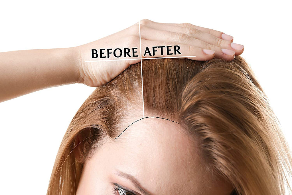 OPO Rice Water Hair Growth Mixture - Extra Strength Herbal Mist for Hair & Scalp