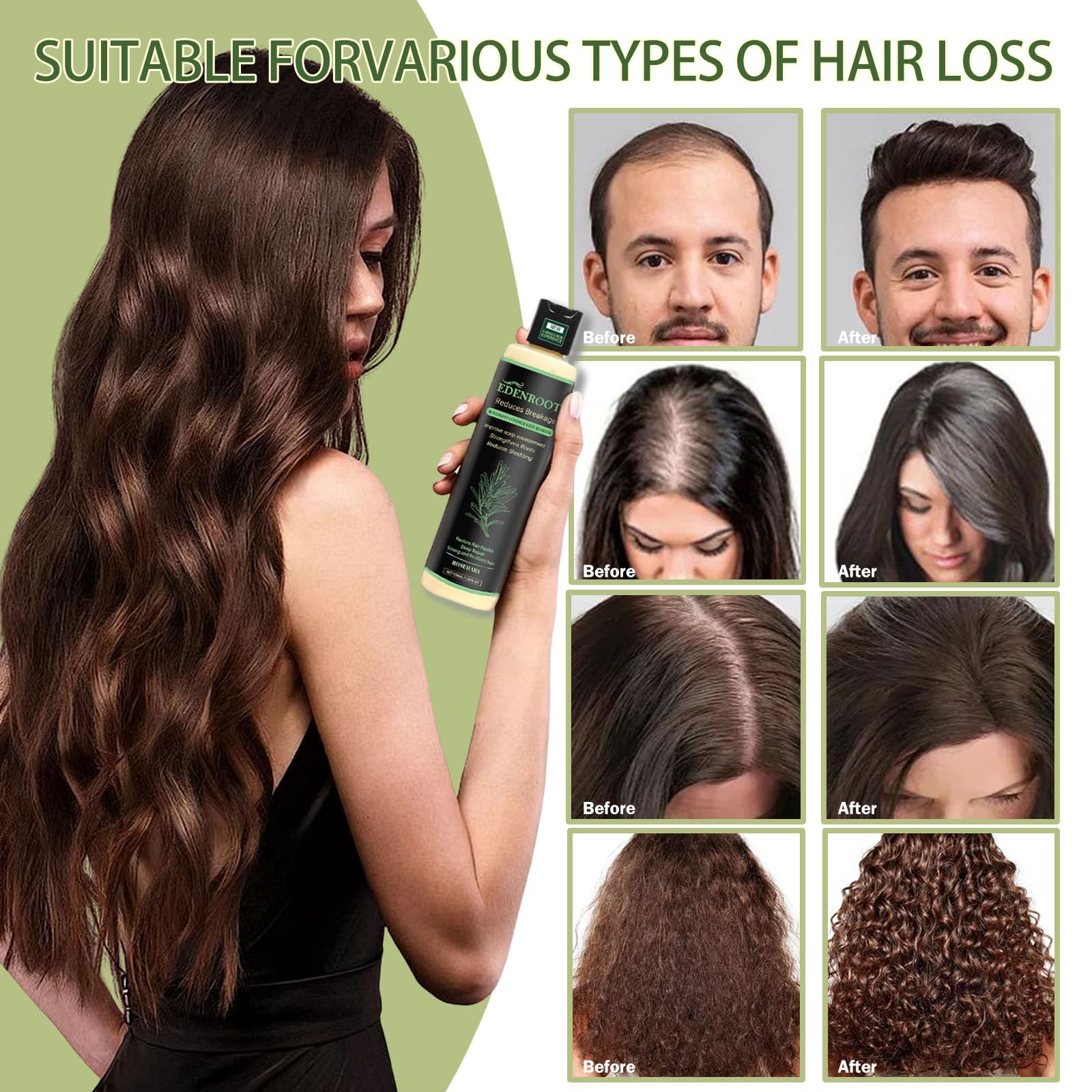 Organic Rosemary Hair Growth Shampoo with Hydrolyzed Keratin – Sulfate-Free Thickening (1 bottle)
