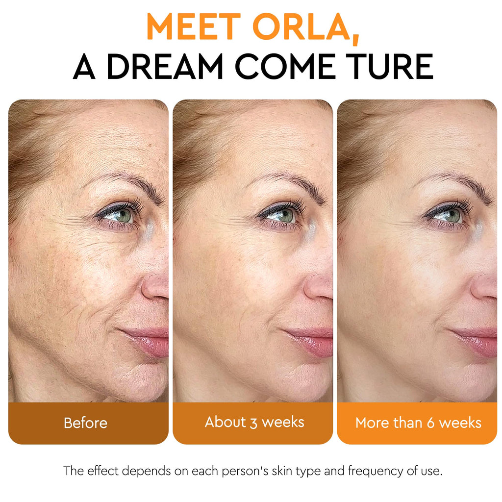 ORLASKIN Super Vitamin C Serum for Women Over 70 – Brightening, Hydration & Gentle Anti Aging 1.7 fl oz