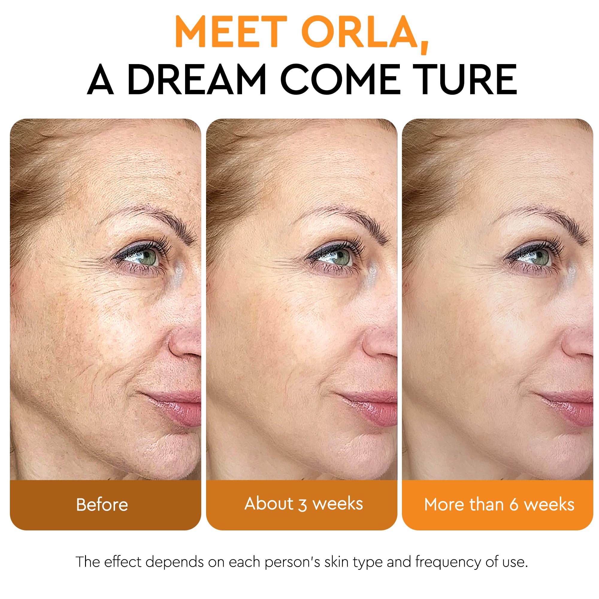 ORLASKIN Super Vitamin C Serum for Women Over 70 – Brightening, Hydration & Gentle Anti Aging 1.7 fl oz