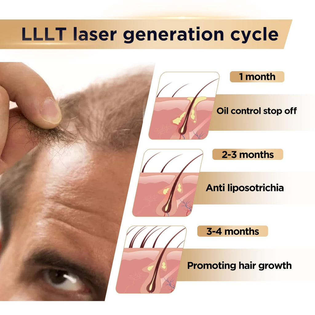 OVEKPA Red Light Therapy Hair Growth Device – FDA Cleared Laser Cap for Hair Regrowth