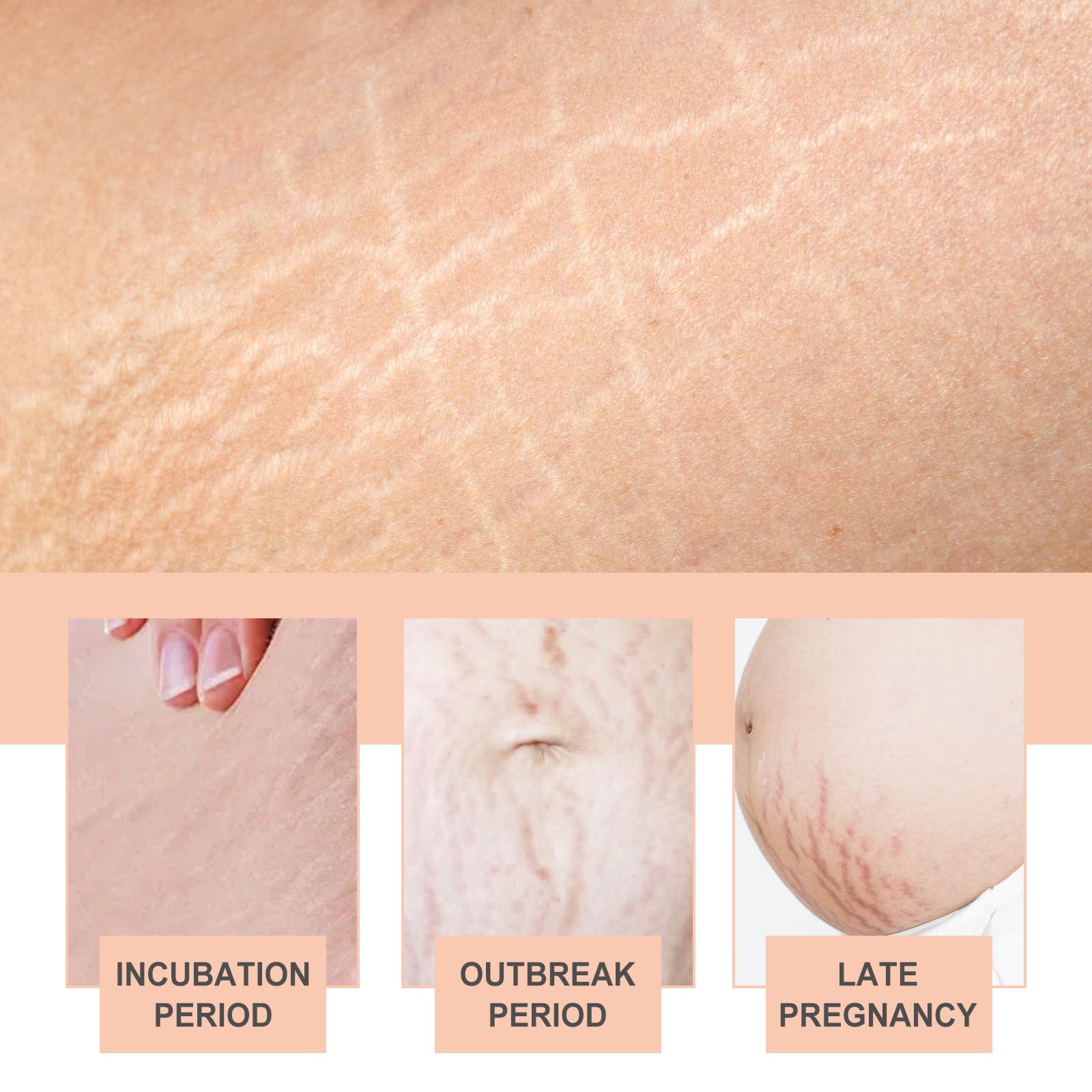 OWILIWO Silicone Belly Patches – Reusable Patch for Stretch Marks & Wrinkles (2pcs)