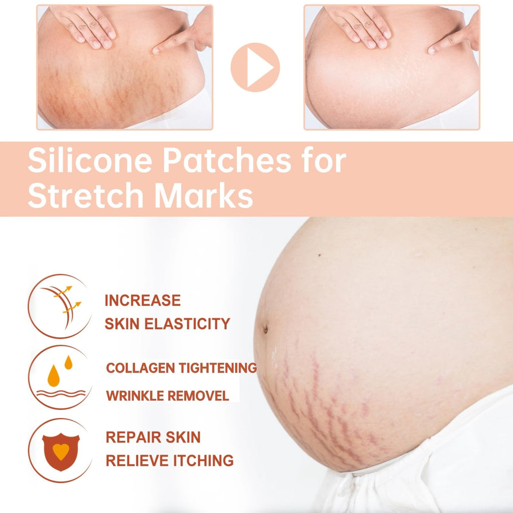 OWILIWO Silicone Belly Patches – Reusable Patch for Stretch Marks & Wrinkles (2pcs)