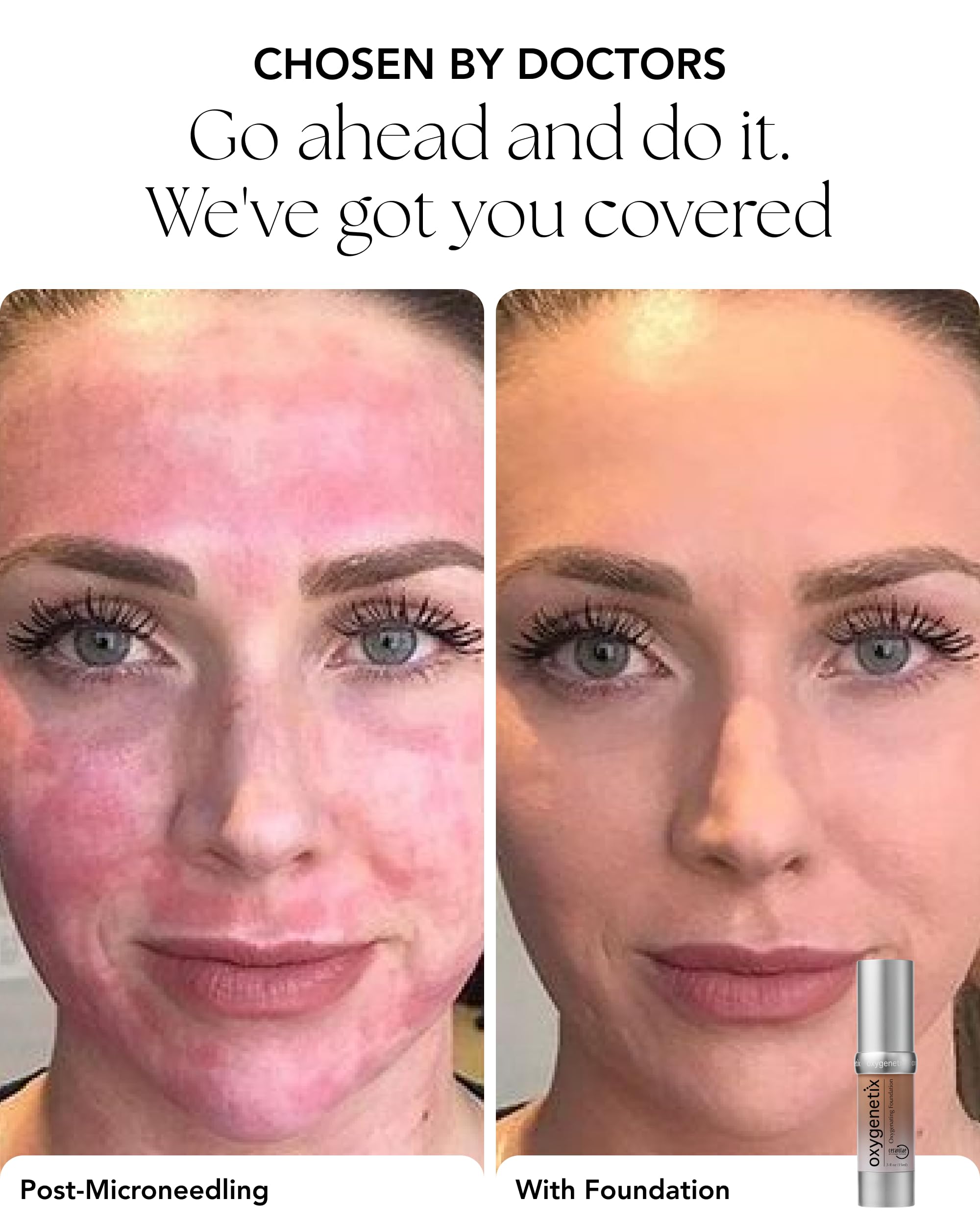 Oxygenetix Oxygenating Foundation – Taupe | Breathable, Buildable Coverage for Sensitive & Post-Treatment Skin