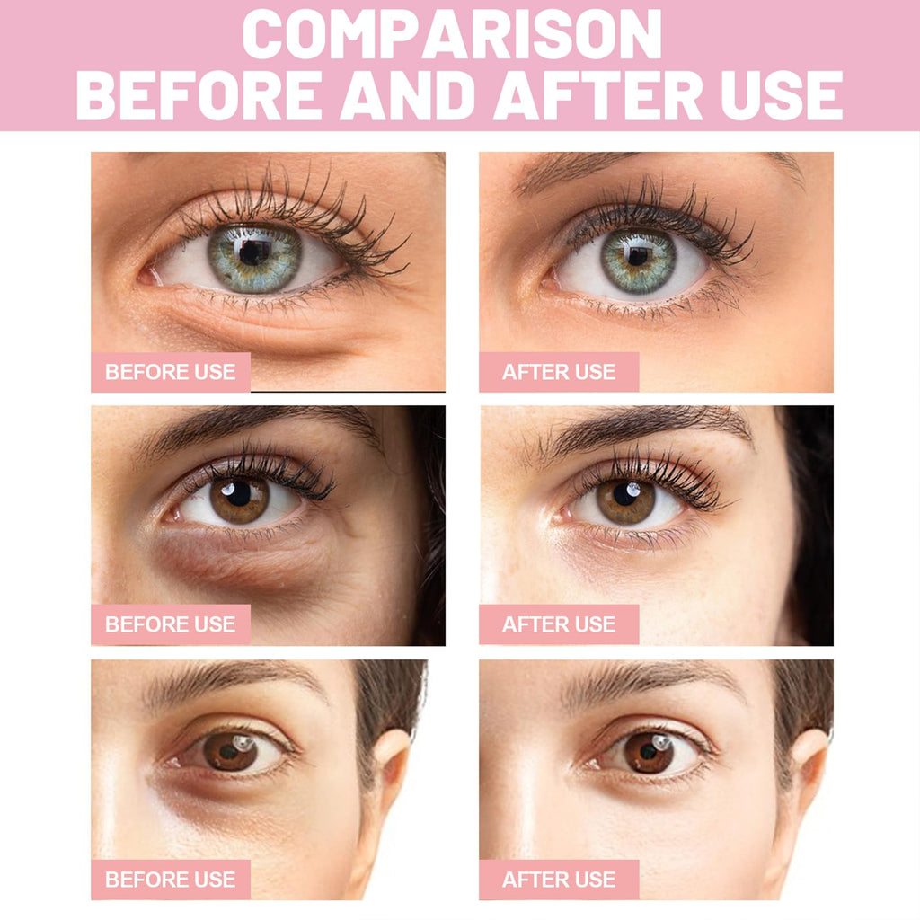 OYKOSE Instalift PDRN & Collagen Eye Patches | Hydrating Niacinamide Under Eye Masks | Serene Skincare, 8 Pairs