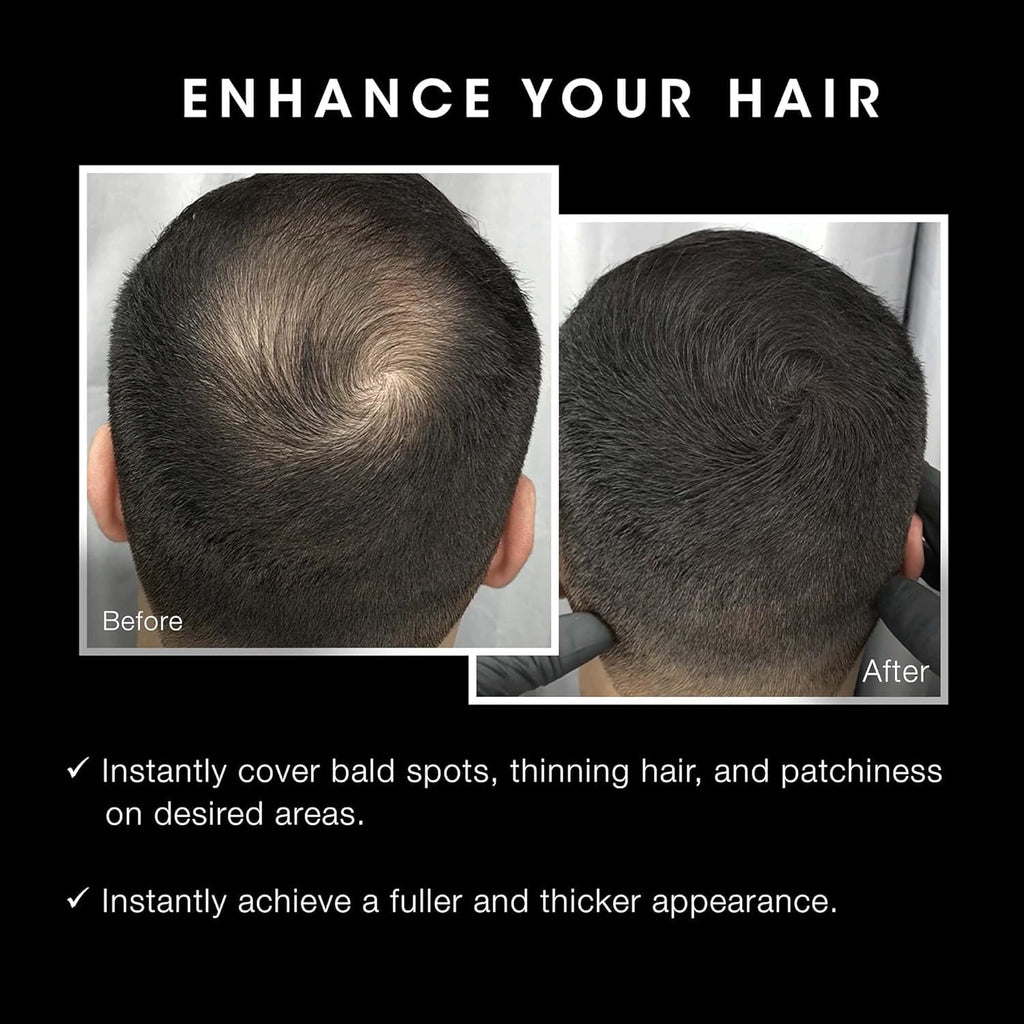 Pacinos Hair Fiber Kit | Conceal Thinning Hair Instantly with Fiber Hold Spray - Dark Brown