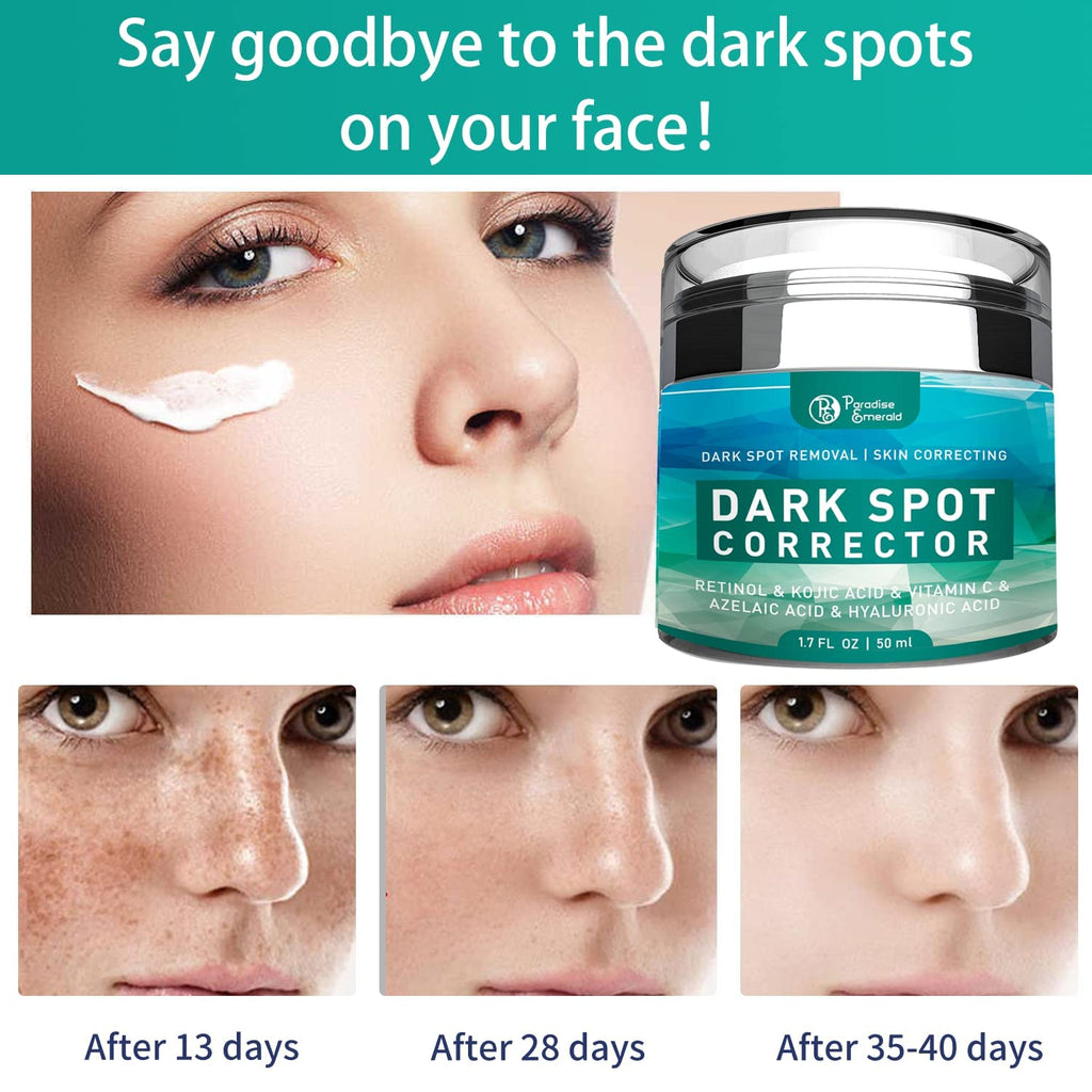 Paradise Emerald Dark Spot Remover for Face – Hyperpigmentation & Sun Spot Treatment for All Skin Types