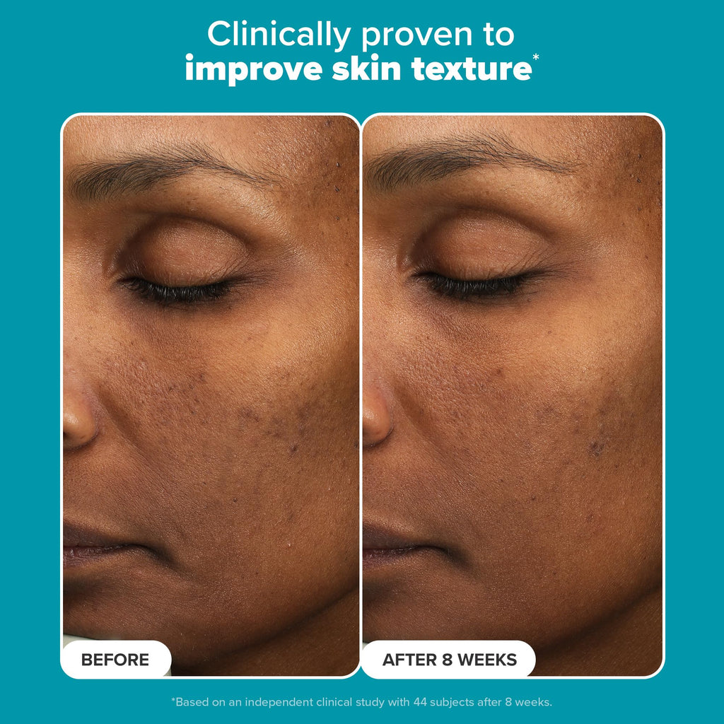 Paula’s Choice 6% Mandelic + 2% Lactic Acid Exfoliant – Gentle Daily AHA for Discoloration & Texture (Fragrance-Free) 3 fl oz