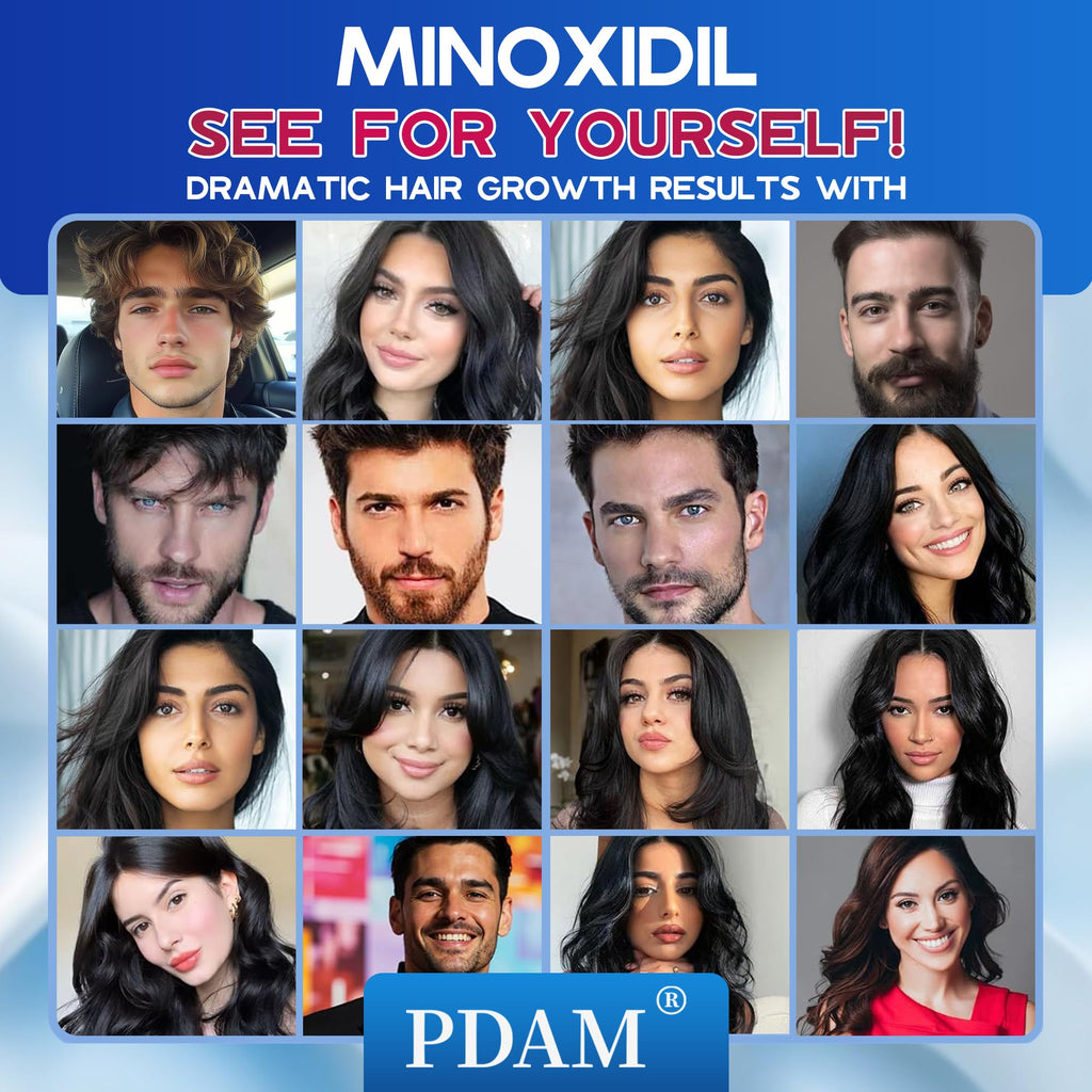 Pdam 5% Minoxidil Foam for Men & Women – Hair Growth Treatment (2 x 2.11 oz)