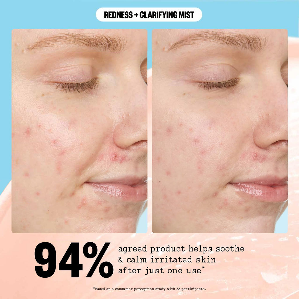 PEACE OUT Redness + Clarifying Mist — Hypochlorous Facial Spray for Acne-Prone Skin