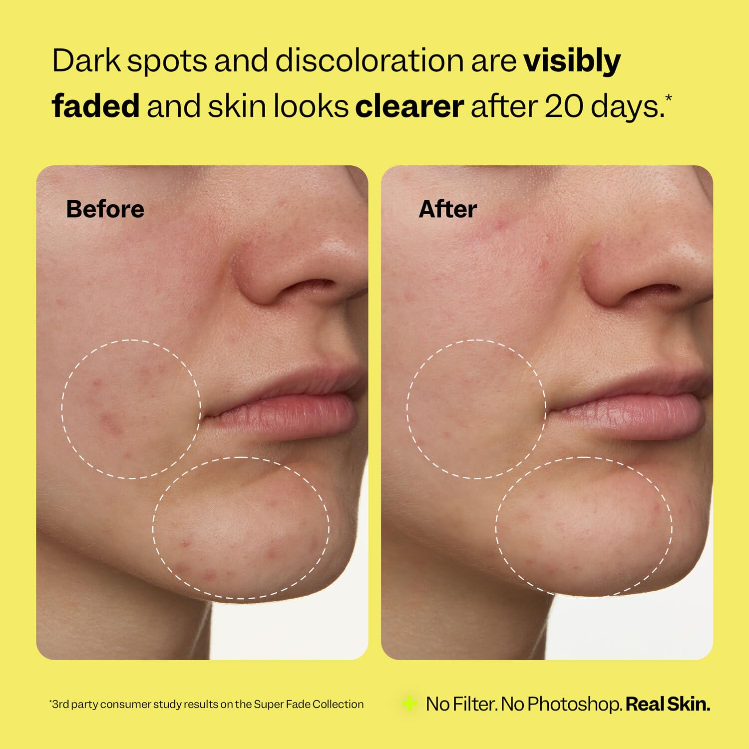 Peach Slices Super Fade Discoloration Serum for Face (1.01 oz) – Niacinamide + Tranexamic Acid | Vegan & Cruelty-Free