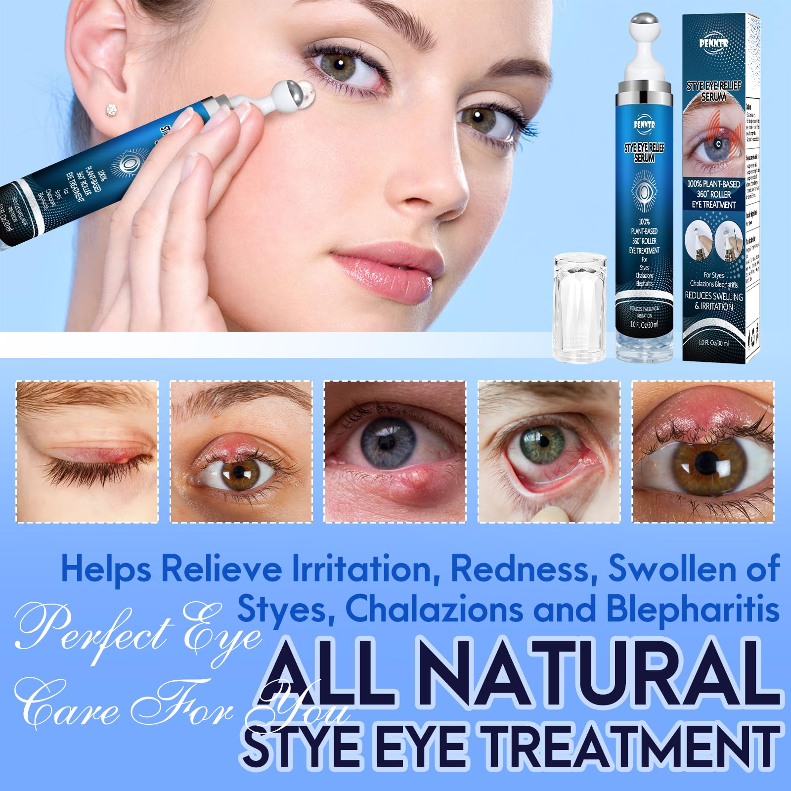 PENNTR Stye Eye Treatment – Plant-Based Roller Serum for Styes, Chalazions & Blepharitis (1 Fl Oz)