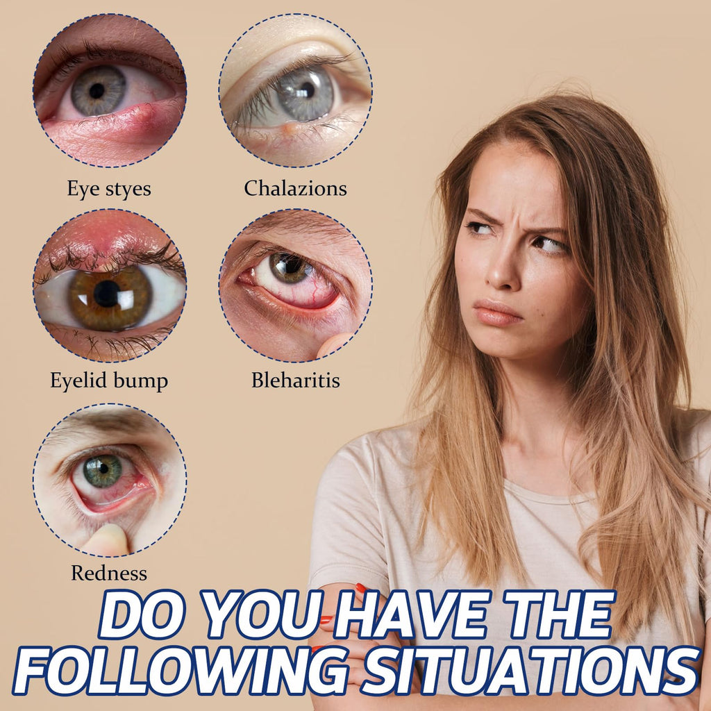PENNTR Stye Eye Treatment Serum for Chalazion & Blepharitis – Sea Buckthorn, Helichrysum, Avocado Oil (1 Fl Oz)