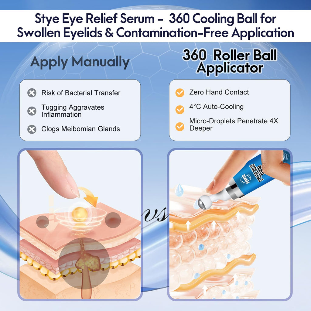 PENNTR Stye Eye Treatment – Plant-Based Roller Serum for Styes, Chalazions & Blepharitis (1 Fl Oz)