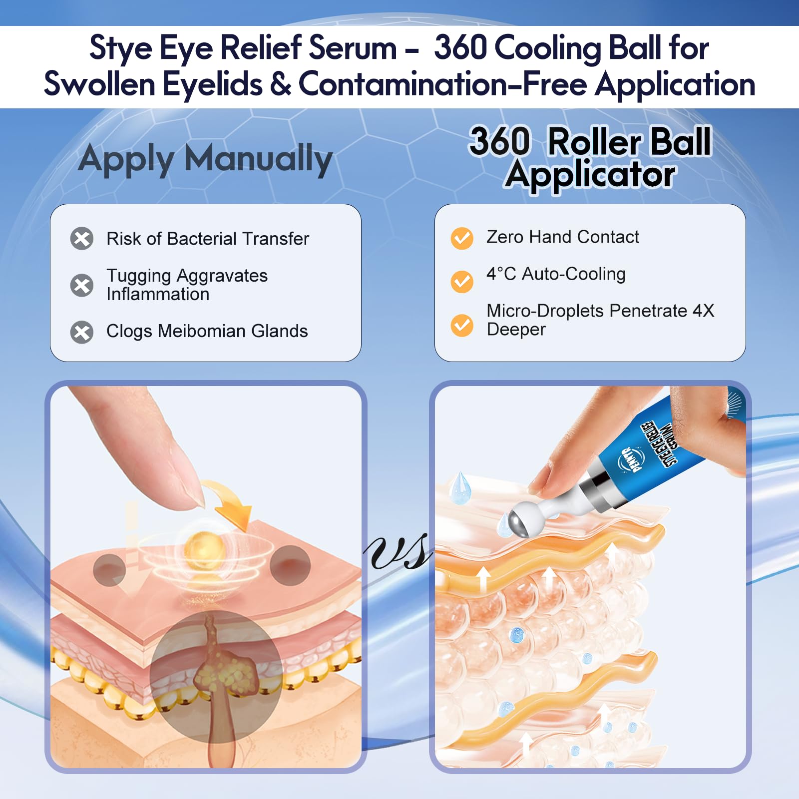 PENNTR Stye Eye Treatment – Plant-Based Roller Serum for Styes, Chalazions & Blepharitis (1 Fl Oz)