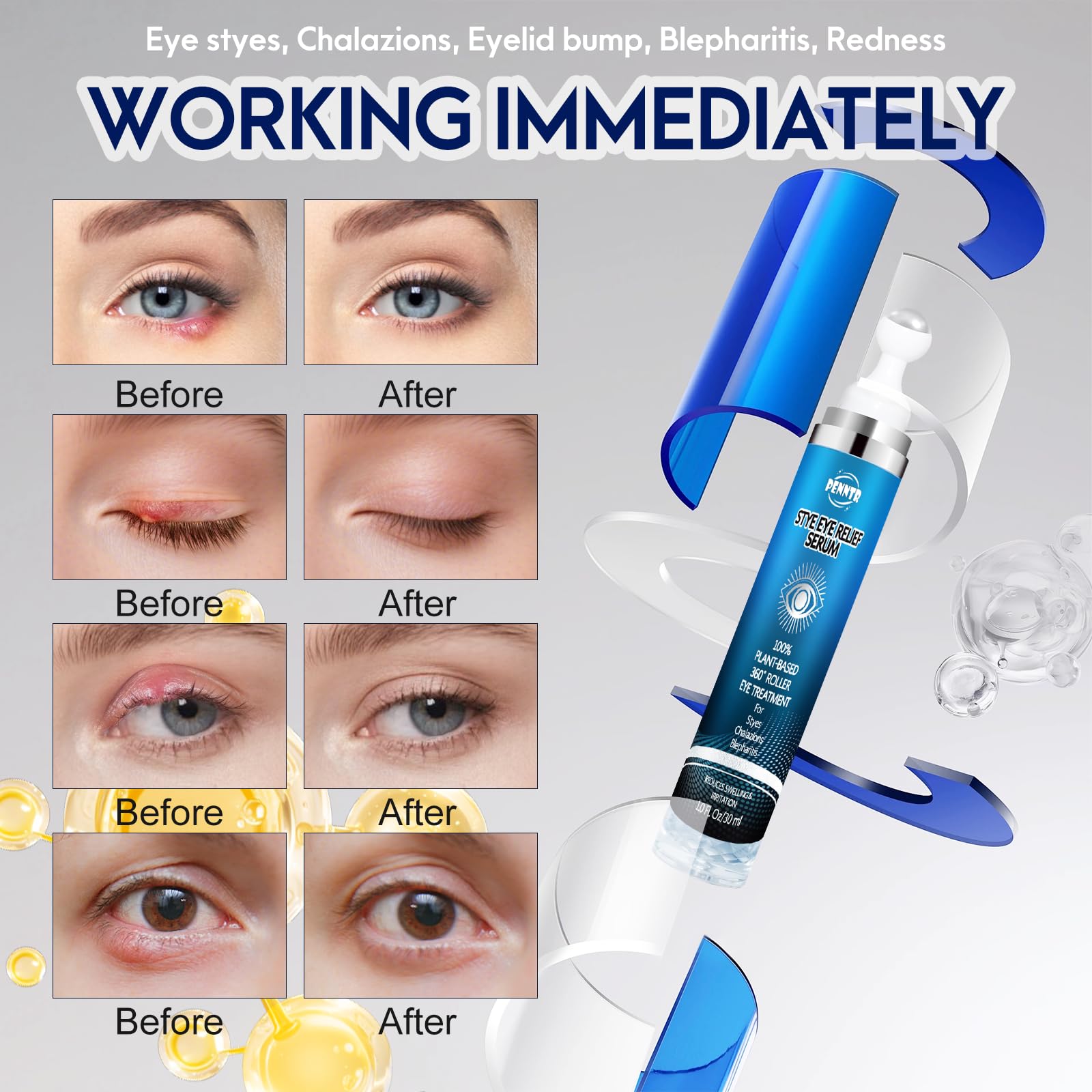 PENNTR Stye Eye Treatment – Plant-Based Roller Serum for Styes, Chalazions & Blepharitis (1 Fl Oz)