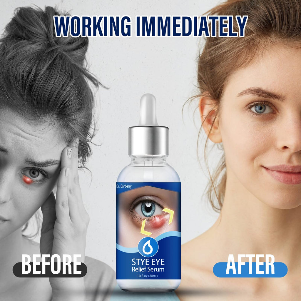 PENNTR Stye Eye Drops - Target Chalazions & Blepharitis, Non-Irritating Eye Treatment with Hippophae Rhamnoides & Avocado Oil (1 Fl. Oz)