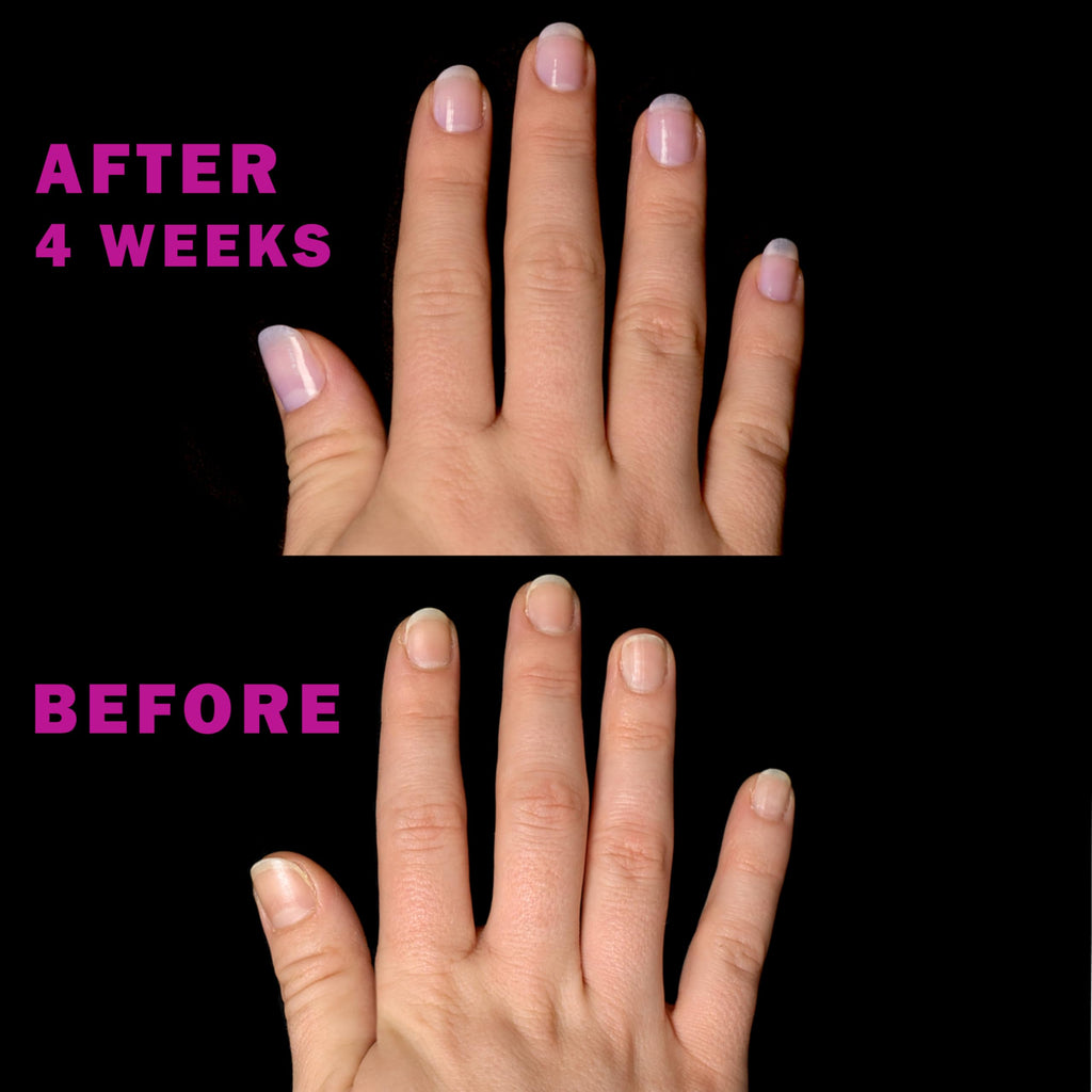 Perfect Formula Nail Essentials Kit – 4-Piece Keratin Nail Strengthener & Growth