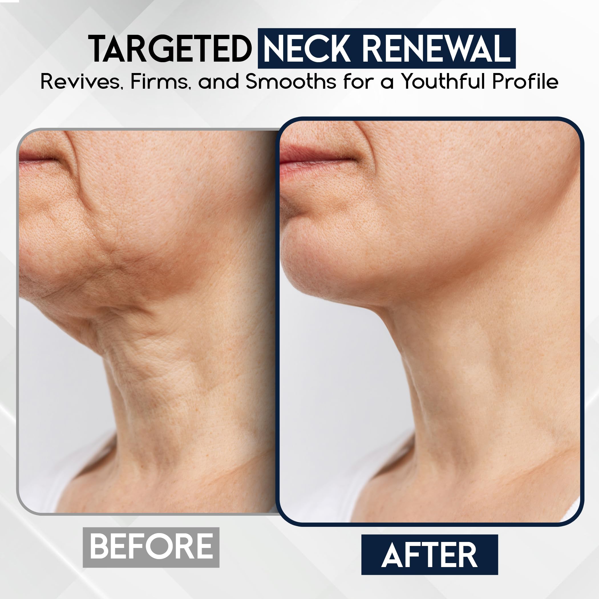 Pharmlitalia Neck Firming Cream – Tighten, Lift & Smooth Neck, Décolleté & Chest