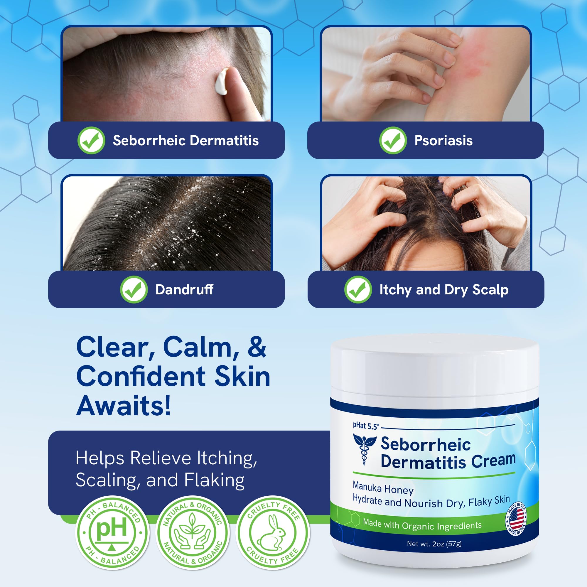 pHat 5.5 Seborrheic Dermatitis Moisturizing Cream & Face Lotion – Hydration, Redness Relief & Anti-Itch (2oz)