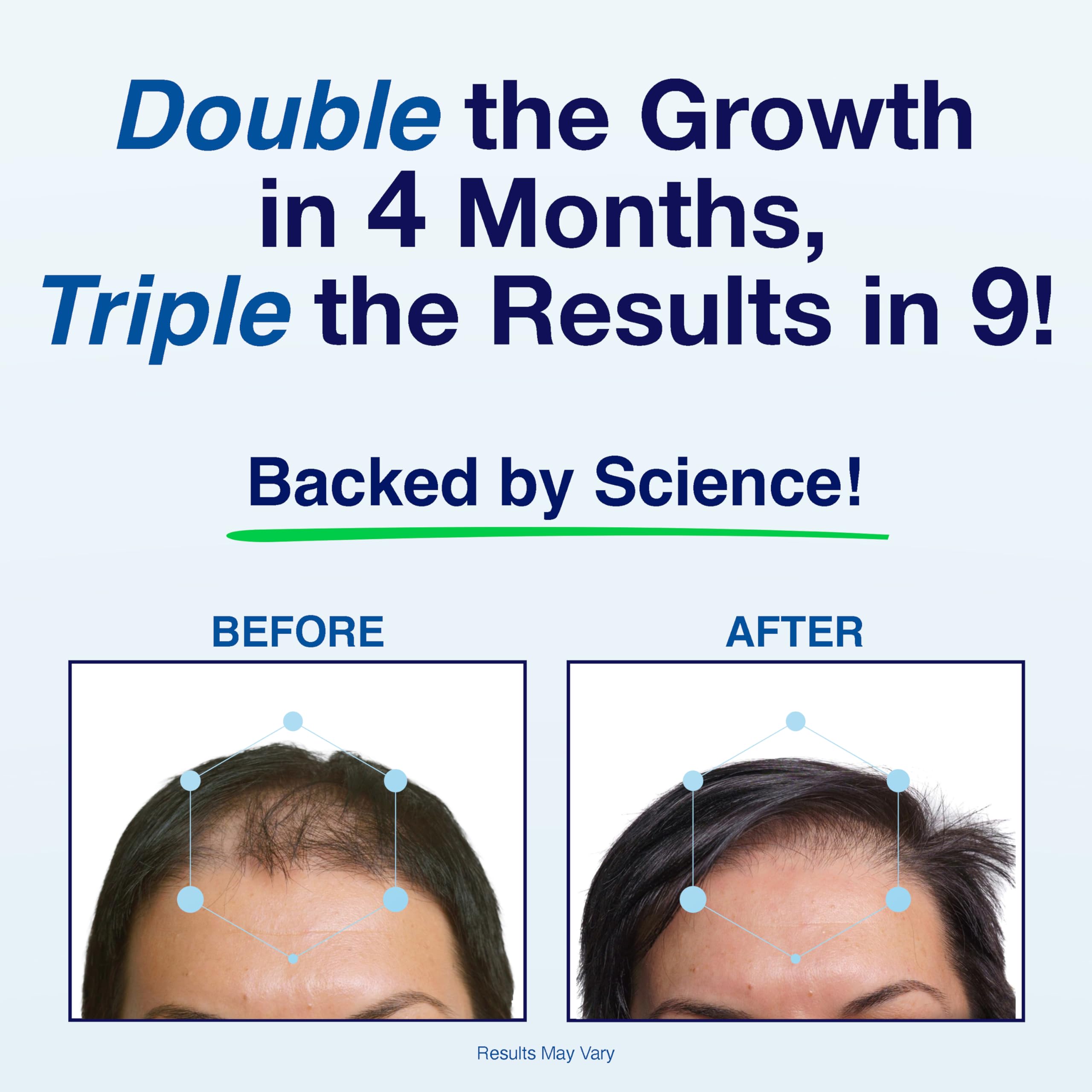 Phyllotex Patented Hair Growth Vitamins for Women & Men | Clinically Proven Hair Loss Supplement | 4 Month Supply