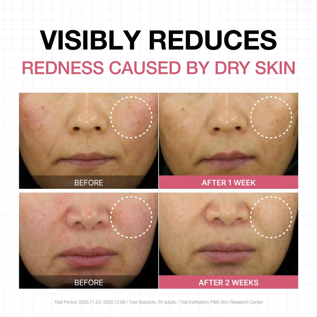 Physiogel Calming Relief Face & Body Lotion – Reduces Redness in 3 Days, Fragrance-Free, Dermatologist-Tested