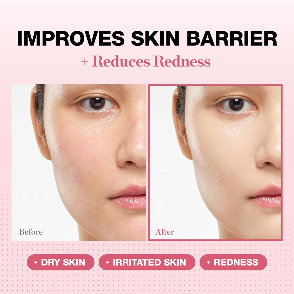 Physiogel Redness Reducing Cream – Ceramide Moisturizer for Sensitive Skin