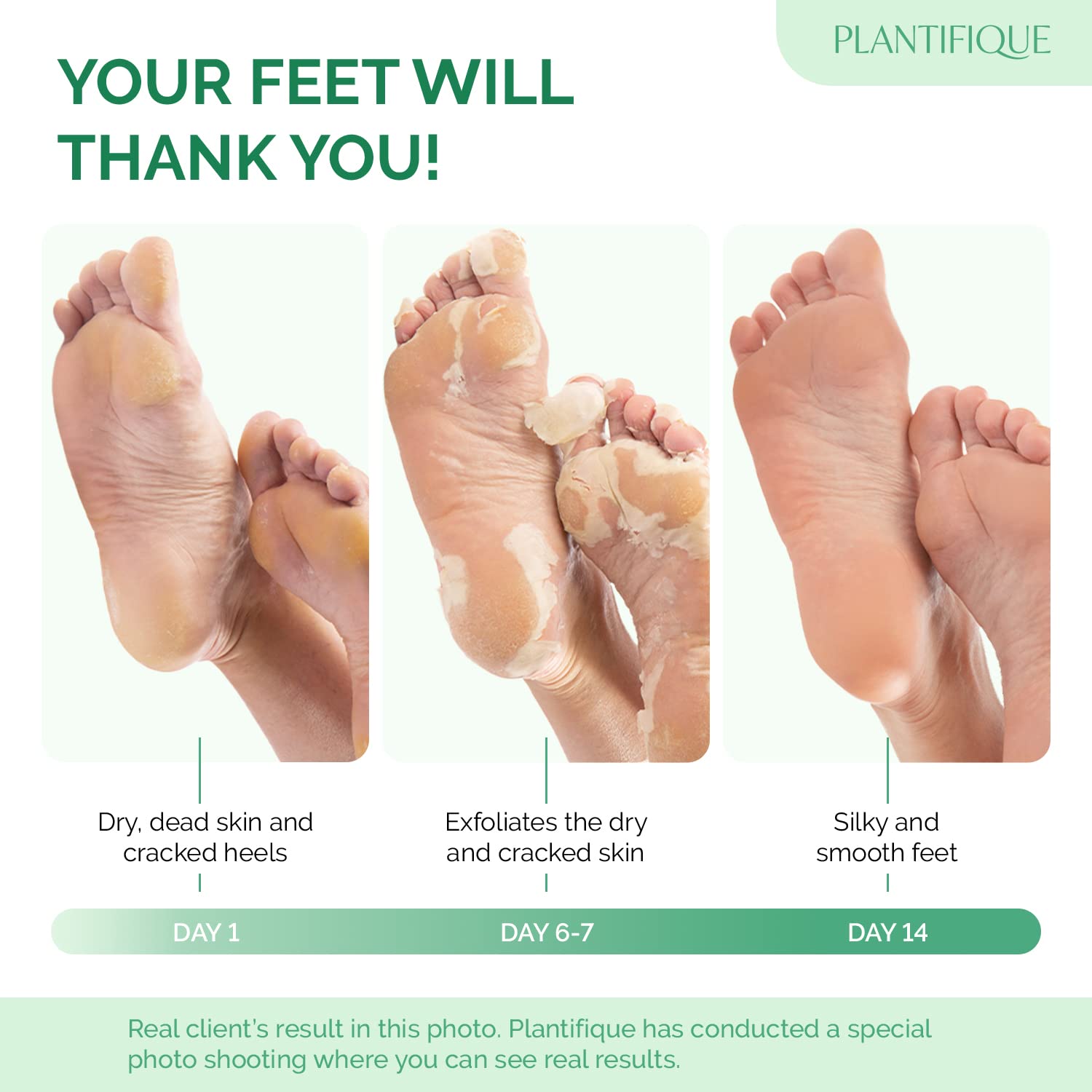 PLANTIFIQUE Foot Peeling Mask 4 Pack | Dermatologically Tested for Baby Soft Feet | Peach