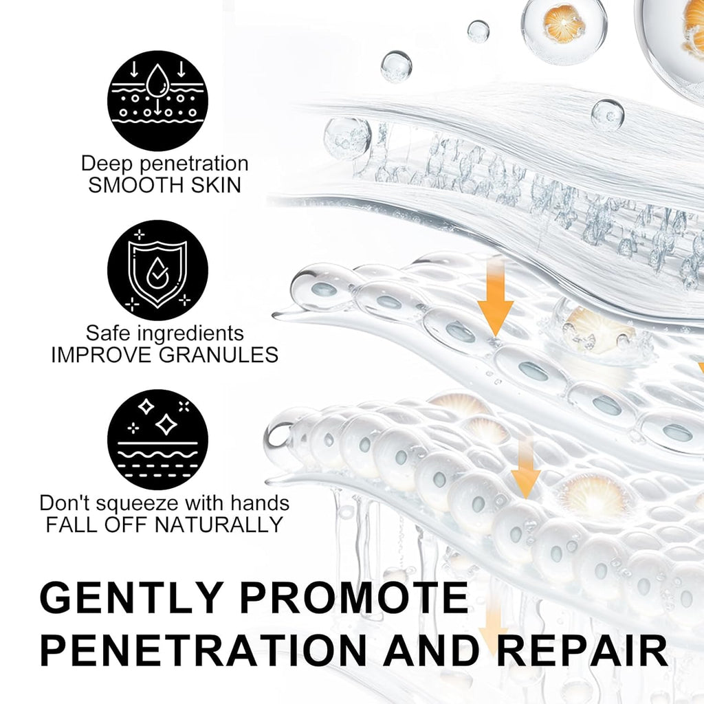 Platicat Milia Remover Serum – Clear Skin Spot Treatment (30ml, 1 Count, Black)