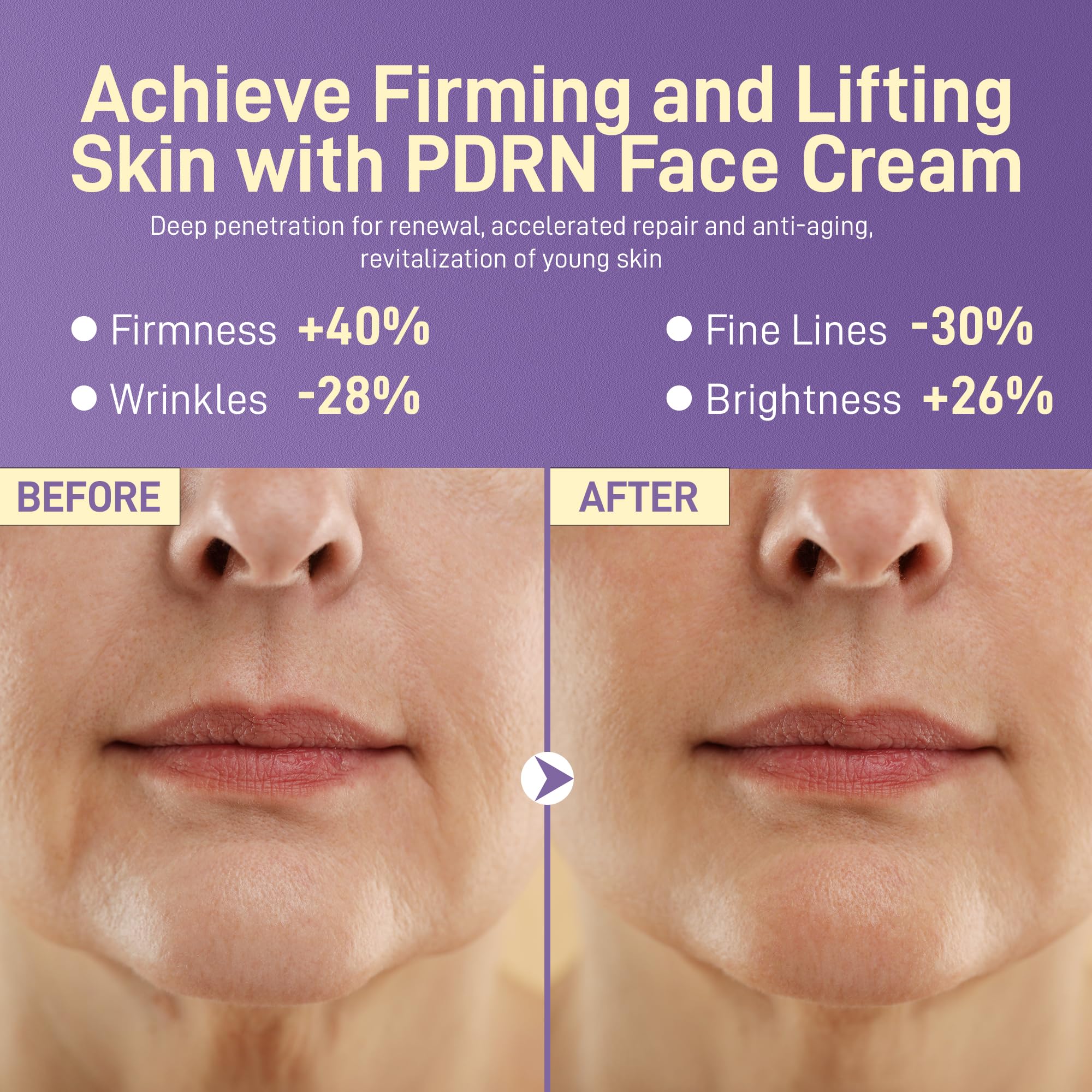 +1HEROLABS PDRN Anti-Aging Face Moisturizer Cream – 5% Squalane, 100% Pure Salmon PDRN, Hyaluronic Acid & B5