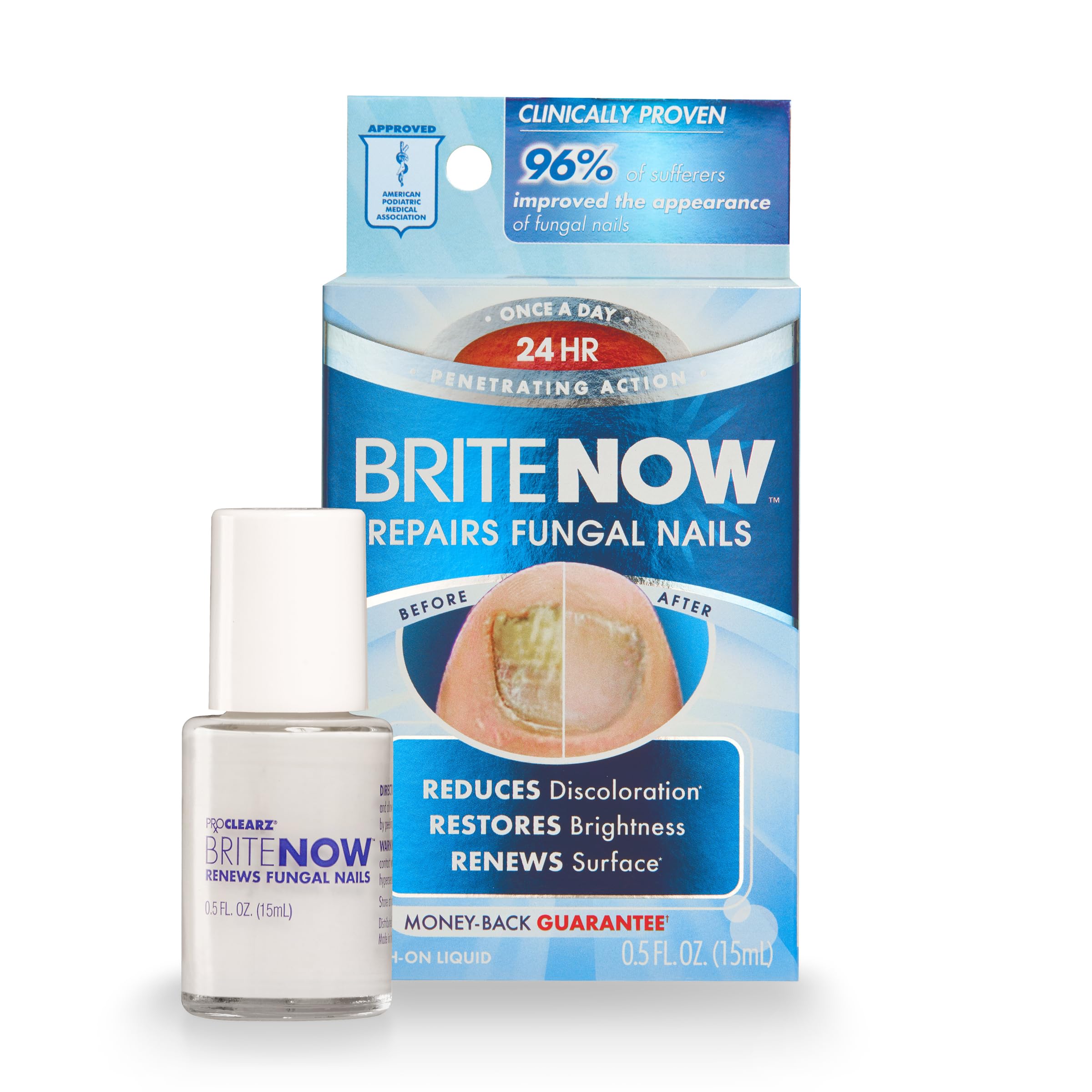 ProClearz Brite Now Nail Treatment - Peel-Away Nail Repair, Brightening & Smoothing, 0.5 oz