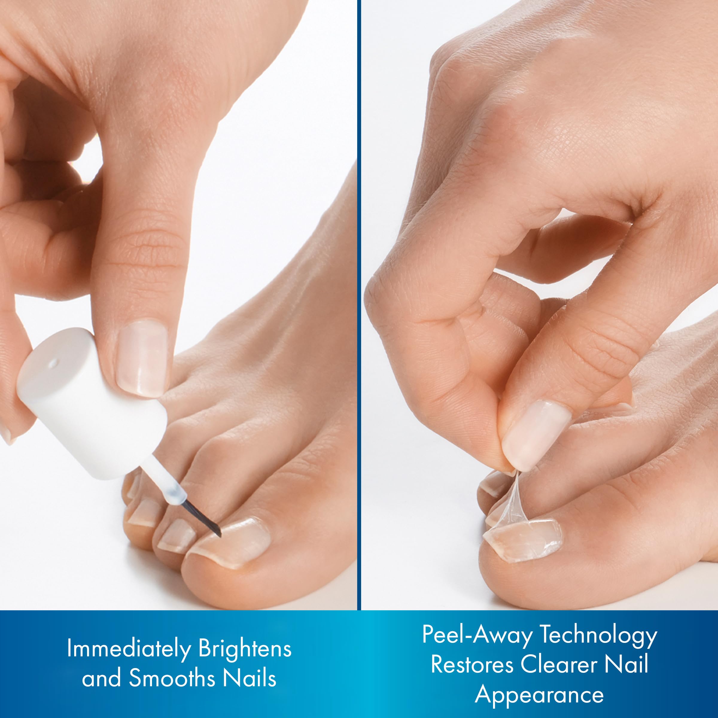 ProClearz Brite Now Nail Treatment - Peel-Away Nail Repair, Brightening & Smoothing, 0.5 oz