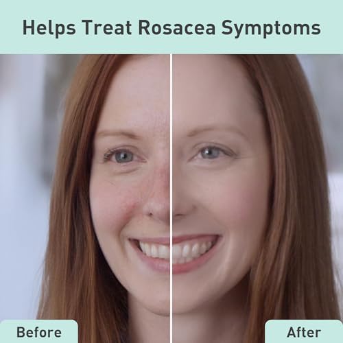 PROcure Rosacare Hydrogel 2 Pack – Lightweight Redness Relief & Color Correction