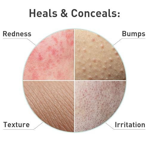 PROcure Rosacare CC Hydrogel – Soothing Color-Correcting Hydration, 2 fl oz