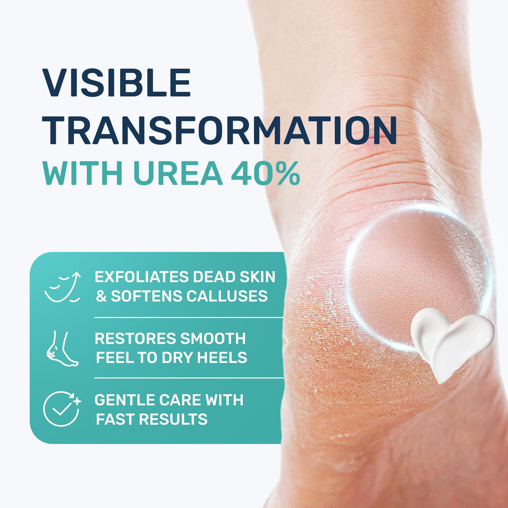 PROJECT 701 Urea Cream 40% & Salicylic Acid – Intensive Foot Exfoliating Lotion