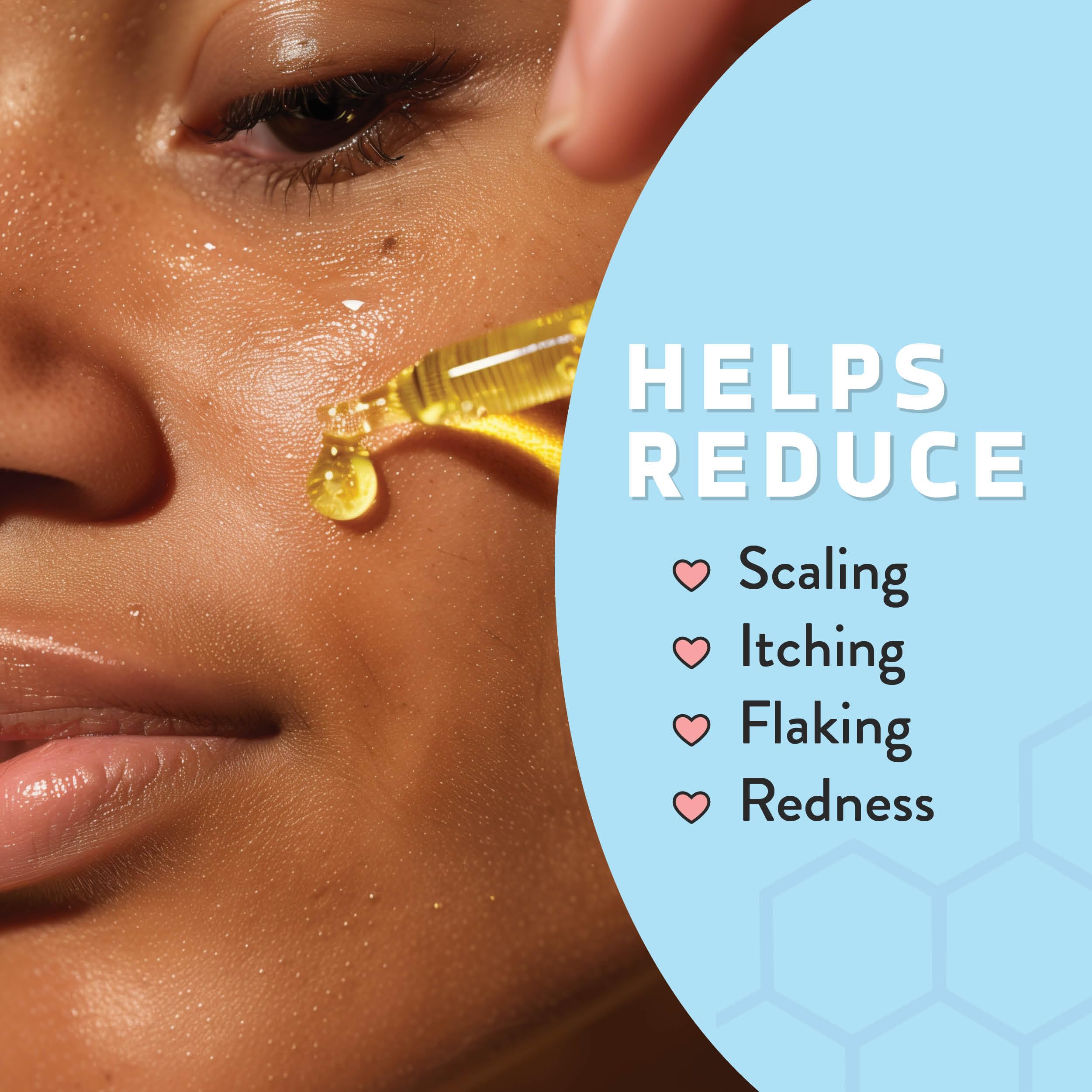 Psoriasis Honey Nourishing Scalp & Skin Serum – Non-Comedogenic Dry Oil for Daily Hydration