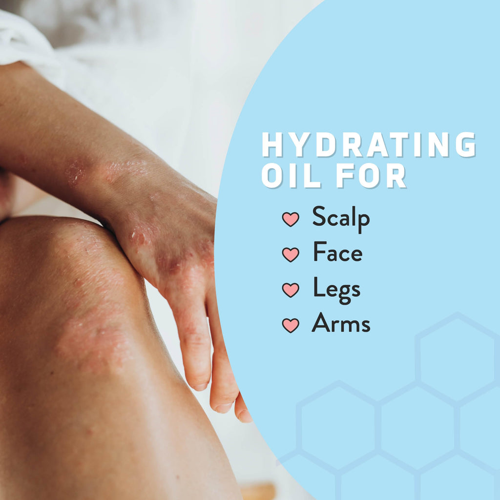 Psoriasis Honey Nourishing Scalp & Skin Serum – Non-Comedogenic Dry Oil for Daily Hydration