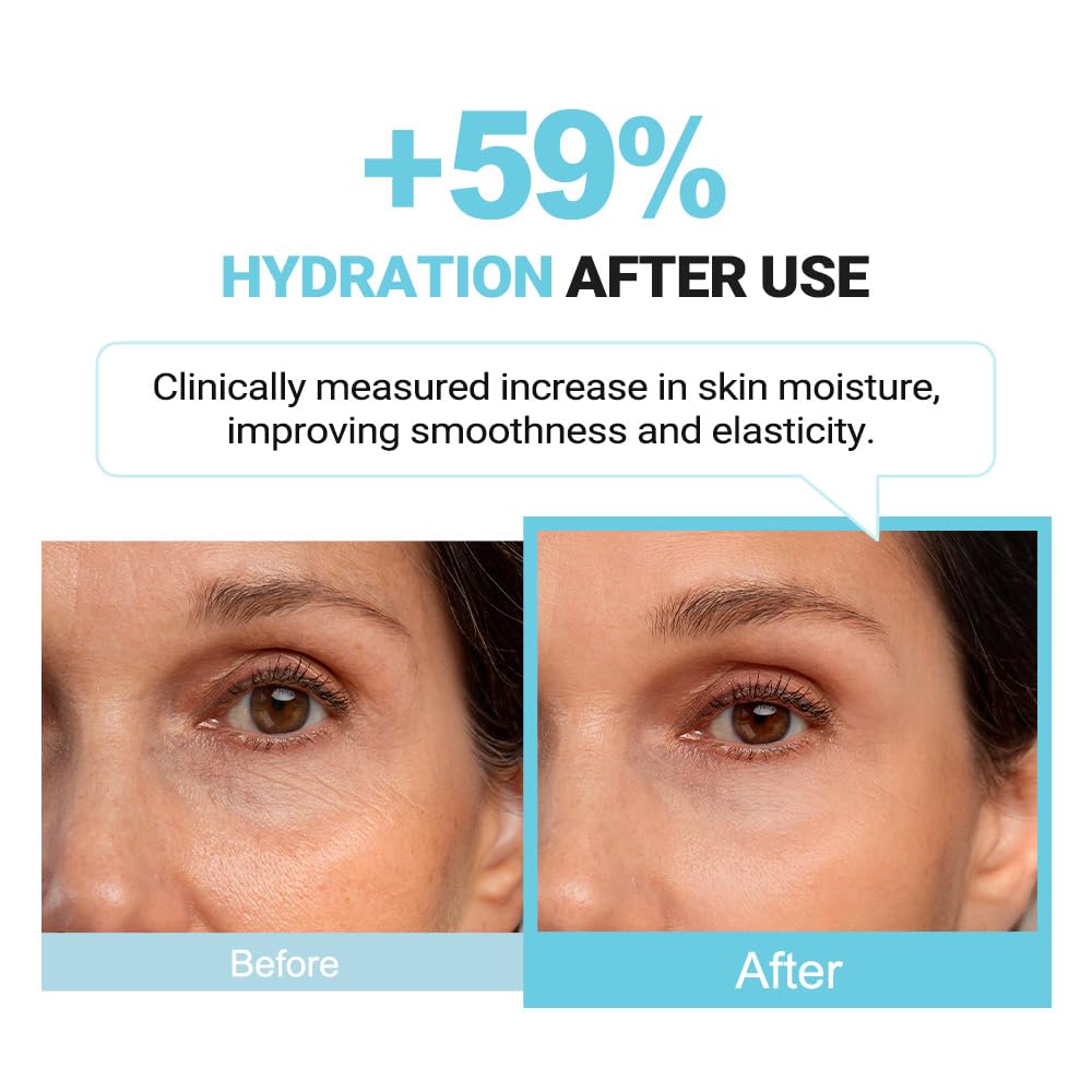 pure.tiful Hydrolyzed Hyaluronic Acid Serum (30ml) – Triple HA Complex for All Ages