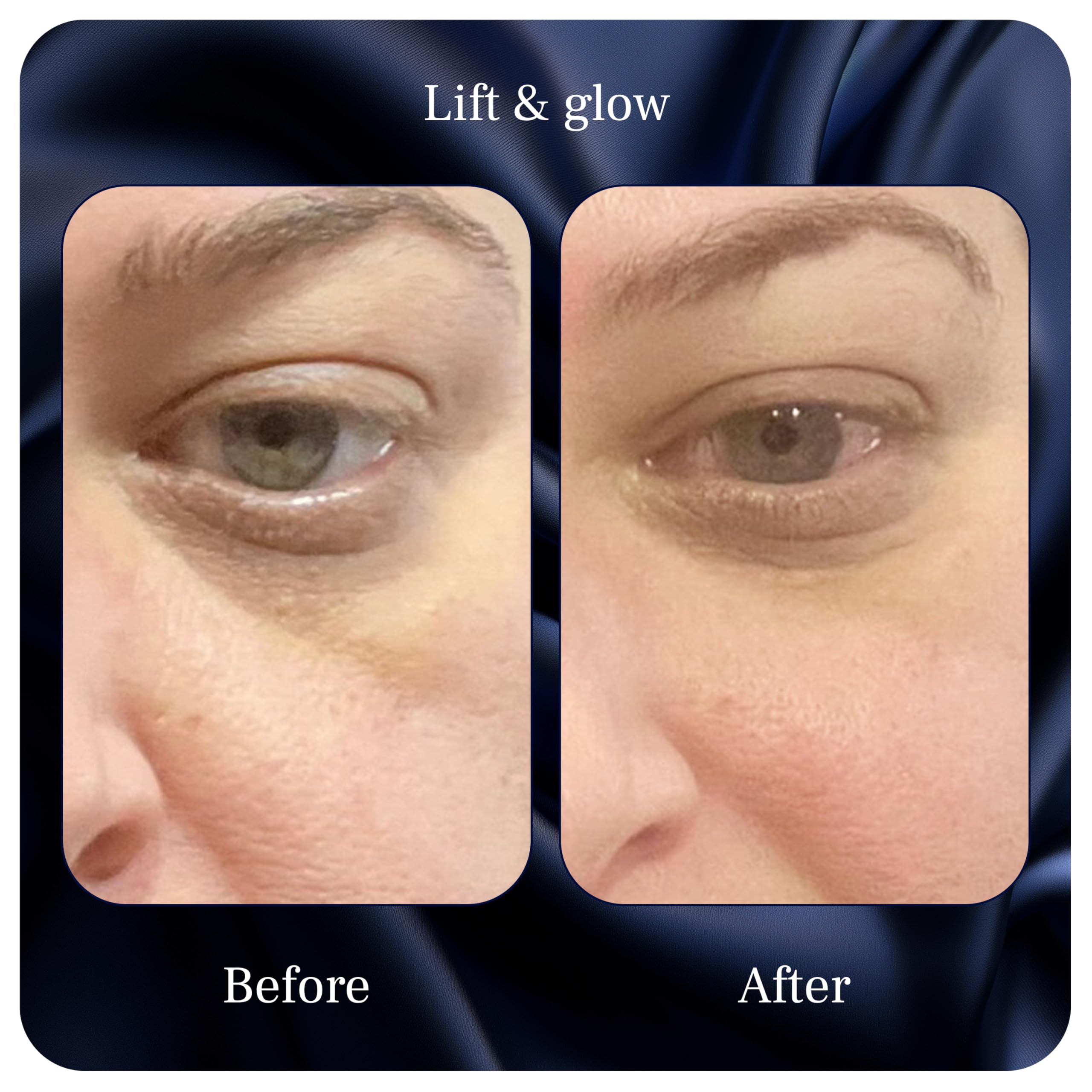 PUREANCE Lift & Glow Organic Eye Cream — Dark Circles, Puffiness & Fine Lines | 1 Fl Oz