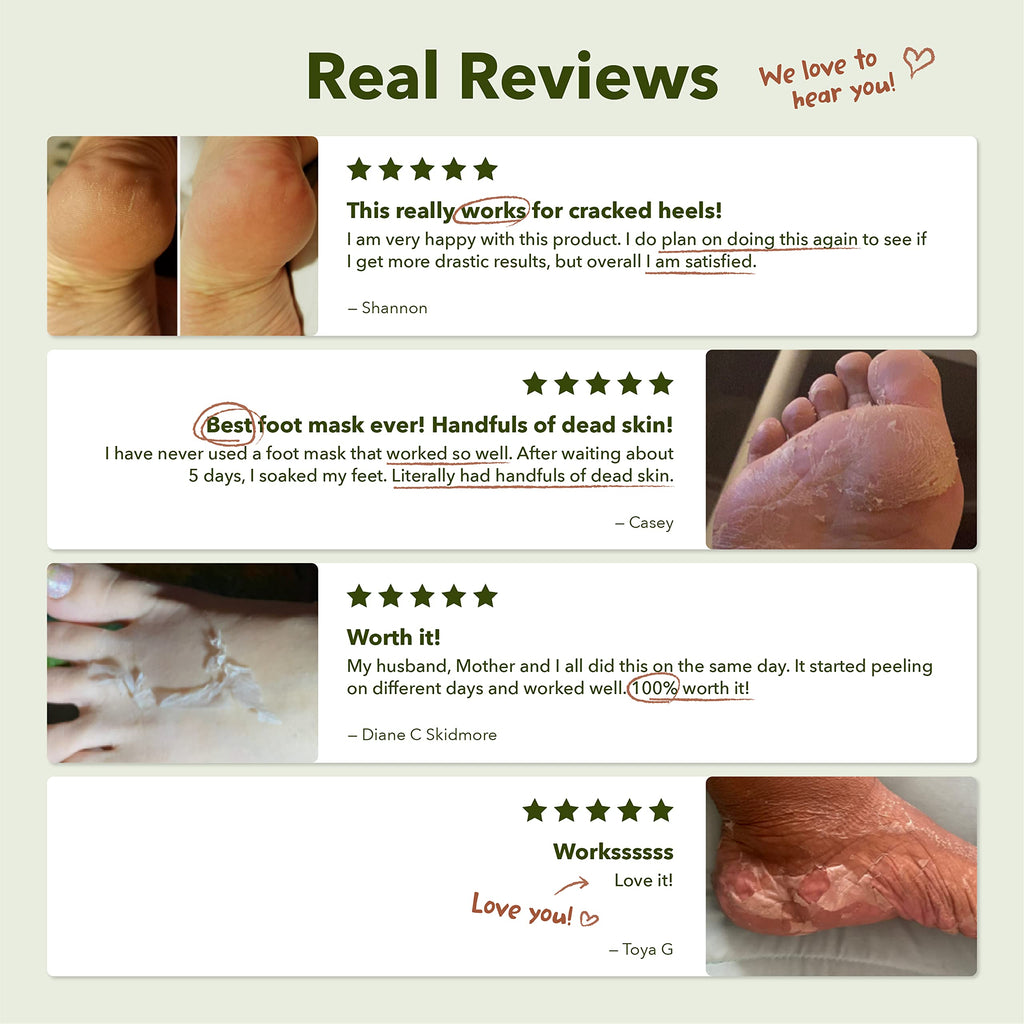 Purederm Shiny & Soft Foot Peeling Mask (6 Pack) – Exfoliating Peel for Smooth, Hydrated Feet