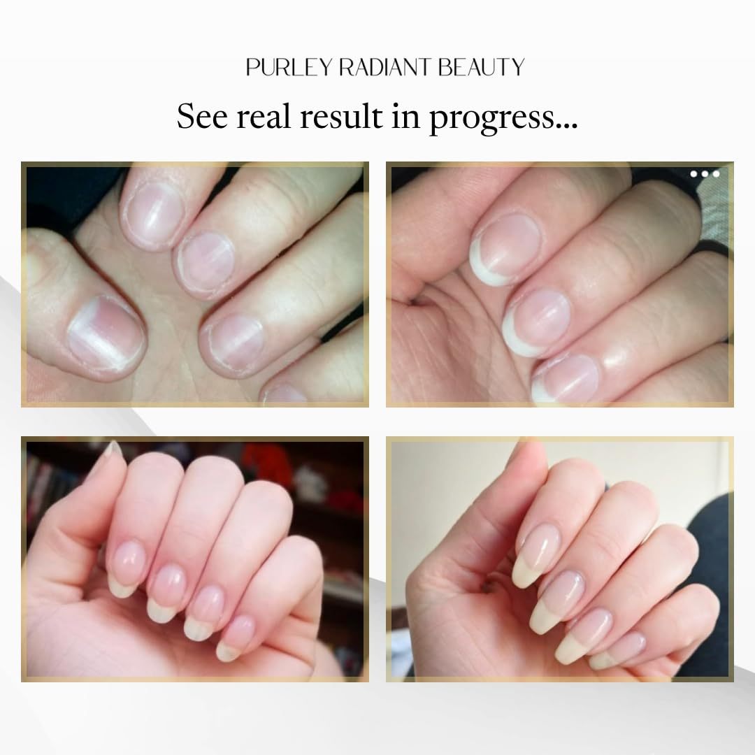Purely Radiant Beauty Nail Growth Oil – Natural Cuticle Serum for Stronger Nails (3ml) | Jojoba, Castor, Coconut & Argan Oils | USA Made
