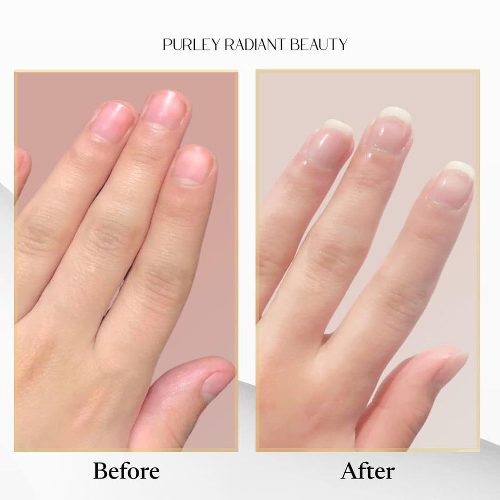 Purely Radiant Beauty Nail Growth Oil – Natural Cuticle Serum for Stronger Nails (3ml) | Jojoba, Castor, Coconut & Argan Oils | USA Made