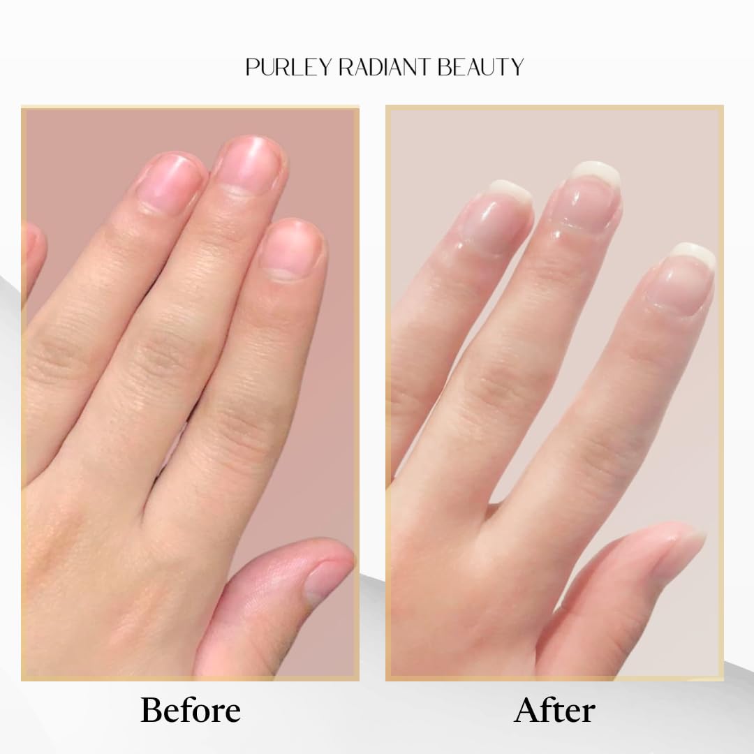 Purely Radiant Beauty Nail Growth Oil – Natural Cuticle Serum for Stronger Nails (3ml) | Jojoba, Castor, Coconut & Argan Oils | USA Made