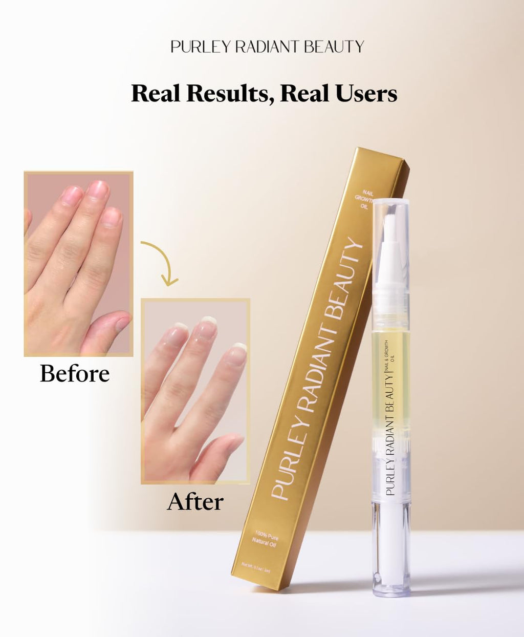 Purely Radiant Beauty Nail Growth Oil – Natural Cuticle Serum for Stronger Nails (3ml) | Jojoba, Castor, Coconut & Argan Oils | USA Made
