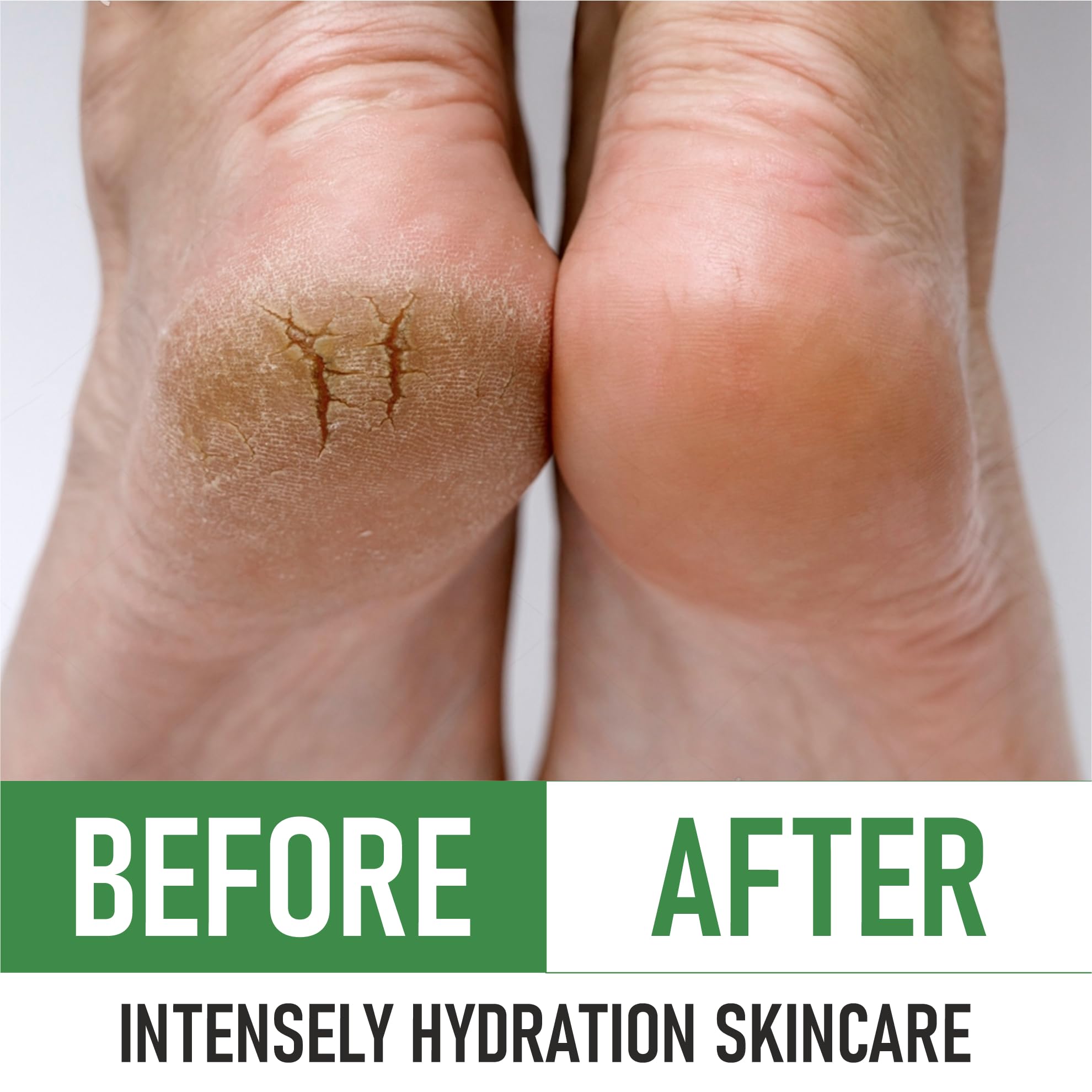 PurOrganica Urea 40% Foot Cream – Intensive Heel Repair | Made in USA
